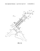 DISPOSABLE MULTI-PURPOSE TOOL FOR TOTAL KNEE ARTHROPLASTY diagram and image