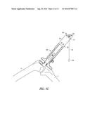 DISPOSABLE MULTI-PURPOSE TOOL FOR TOTAL KNEE ARTHROPLASTY diagram and image