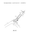 DISPOSABLE MULTI-PURPOSE TOOL FOR TOTAL KNEE ARTHROPLASTY diagram and image