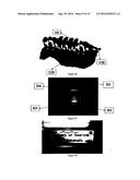 Instant crankshaft device for piston engines and bearing shafts diagram and image