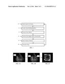 Three-dimensional volume of interest in ultrasound imaging diagram and image