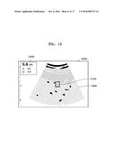 ULTRASOUND IMAGING APPARATUS AND METHOD OF PROCESSING ULTRASOUND IMAGE     THEREOF diagram and image