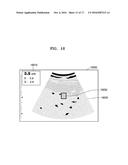 ULTRASOUND IMAGING APPARATUS AND METHOD OF PROCESSING ULTRASOUND IMAGE     THEREOF diagram and image