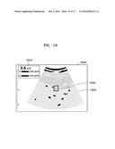 ULTRASOUND IMAGING APPARATUS AND METHOD OF PROCESSING ULTRASOUND IMAGE     THEREOF diagram and image