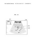 ULTRASOUND IMAGING APPARATUS AND METHOD OF PROCESSING ULTRASOUND IMAGE     THEREOF diagram and image