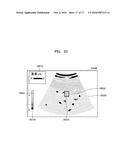 ULTRASOUND IMAGING APPARATUS AND METHOD OF PROCESSING ULTRASOUND IMAGE     THEREOF diagram and image