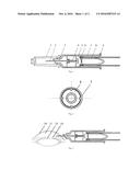 A Disposable Negative-pressure Anterior Chamber Paracentesis syringe diagram and image