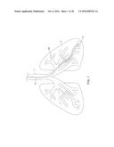 PULMONARY BIOPSY DEVICES diagram and image