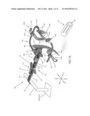 ORAL RETRACTION DEVICES AND METHODS diagram and image