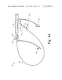 APPARATUS FOR CLOSURE OF ATRIAL SEPTAL DEFECTS diagram and image