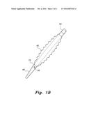 APPARATUS FOR CLOSURE OF ATRIAL SEPTAL DEFECTS diagram and image