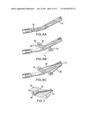 ARTICULATING SUTURING DEVICE AND METHOD diagram and image