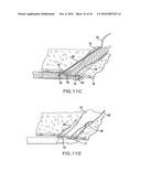 ARTICULATING SUTURING DEVICE AND METHOD diagram and image