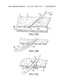 ARTICULATING SUTURING DEVICE AND METHOD diagram and image