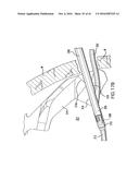 ARTICULATING SUTURING DEVICE AND METHOD diagram and image