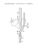 ARTICULATING SUTURING DEVICE AND METHOD diagram and image