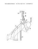 ARTICULATING SUTURING DEVICE AND METHOD diagram and image