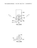 ARTICULATING SUTURING DEVICE AND METHOD diagram and image