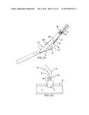 ARTICULATING SUTURING DEVICE AND METHOD diagram and image