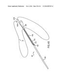 ARTICULATING SUTURING DEVICE AND METHOD diagram and image