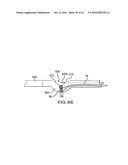 ARTICULATING SUTURING DEVICE AND METHOD diagram and image