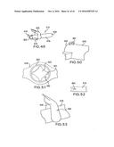 ARTICULATING SUTURING DEVICE AND METHOD diagram and image