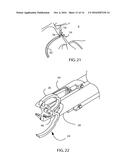 PATENT FORAMEN OVALE CLOSURE SYSTEM diagram and image