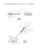 DISENGAGABLE CAM SYSTEM FOR TISSUE PUNCTURE CLOSURE DEVICE AND METHODS diagram and image