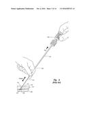 DISENGAGABLE CAM SYSTEM FOR TISSUE PUNCTURE CLOSURE DEVICE AND METHODS diagram and image