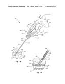 DISENGAGABLE CAM SYSTEM FOR TISSUE PUNCTURE CLOSURE DEVICE AND METHODS diagram and image