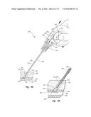 DISENGAGABLE CAM SYSTEM FOR TISSUE PUNCTURE CLOSURE DEVICE AND METHODS diagram and image