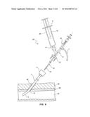 BIOADHESIVE DELIVERY CATHETER MANIFOLD WITH MIXING FIXTURE AND METHODS diagram and image