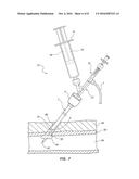 BIOADHESIVE DELIVERY CATHETER MANIFOLD WITH MIXING FIXTURE AND METHODS diagram and image