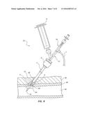 BIOADHESIVE DELIVERY CATHETER MANIFOLD WITH MIXING FIXTURE AND METHODS diagram and image