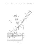 BIOADHESIVE DELIVERY CATHETER MANIFOLD WITH MIXING FIXTURE AND METHODS diagram and image