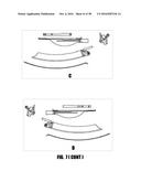 METHODS AND DEVICES FOR SURGICAL ACCESS diagram and image