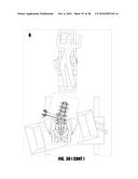 METHODS AND DEVICES FOR SURGICAL ACCESS diagram and image