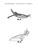 METHODS AND DEVICES FOR SURGICAL ACCESS diagram and image