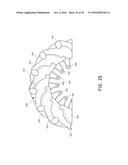 SYSTEMS FOR THE PREVENTION OF SURGICAL SITE INFECTIONS diagram and image