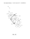 SYSTEMS FOR THE PREVENTION OF SURGICAL SITE INFECTIONS diagram and image