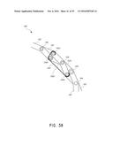 SYSTEMS FOR THE PREVENTION OF SURGICAL SITE INFECTIONS diagram and image