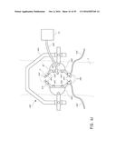 SYSTEMS FOR THE PREVENTION OF SURGICAL SITE INFECTIONS diagram and image