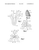 Suture Anchor With Soft Anchor Of Electrospun Fibers diagram and image