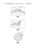 METHOD OF REPAIRING CARTILAGE DEFECTS diagram and image