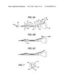 KNOTLESS SUTURE ANCHOR diagram and image