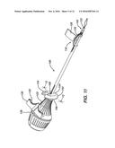 KNOTLESS SUTURE ANCHOR diagram and image