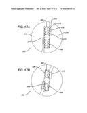 KNOTLESS SUTURE ANCHOR diagram and image