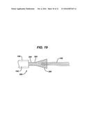 ANCHOR DRIVER WITH SUTURE CLUTCH diagram and image