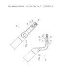 SUTURE PASSER AND METHOD diagram and image