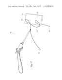 SUTURE PASSER AND METHOD diagram and image